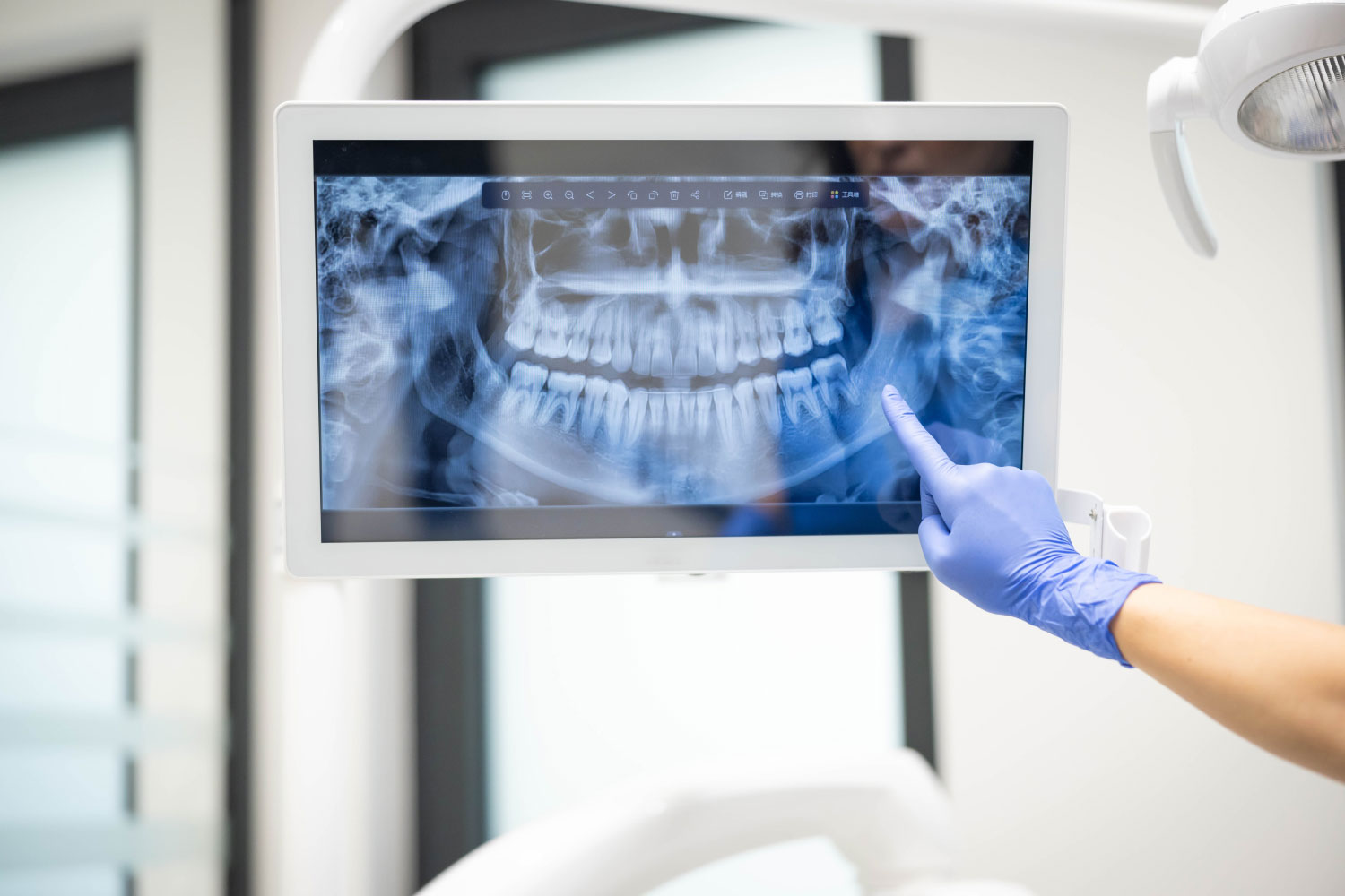 Digital x-rays