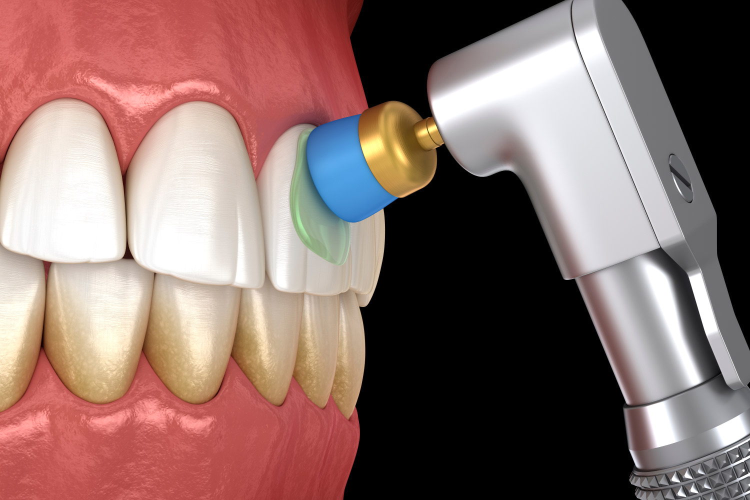 Dentist dental hygiene